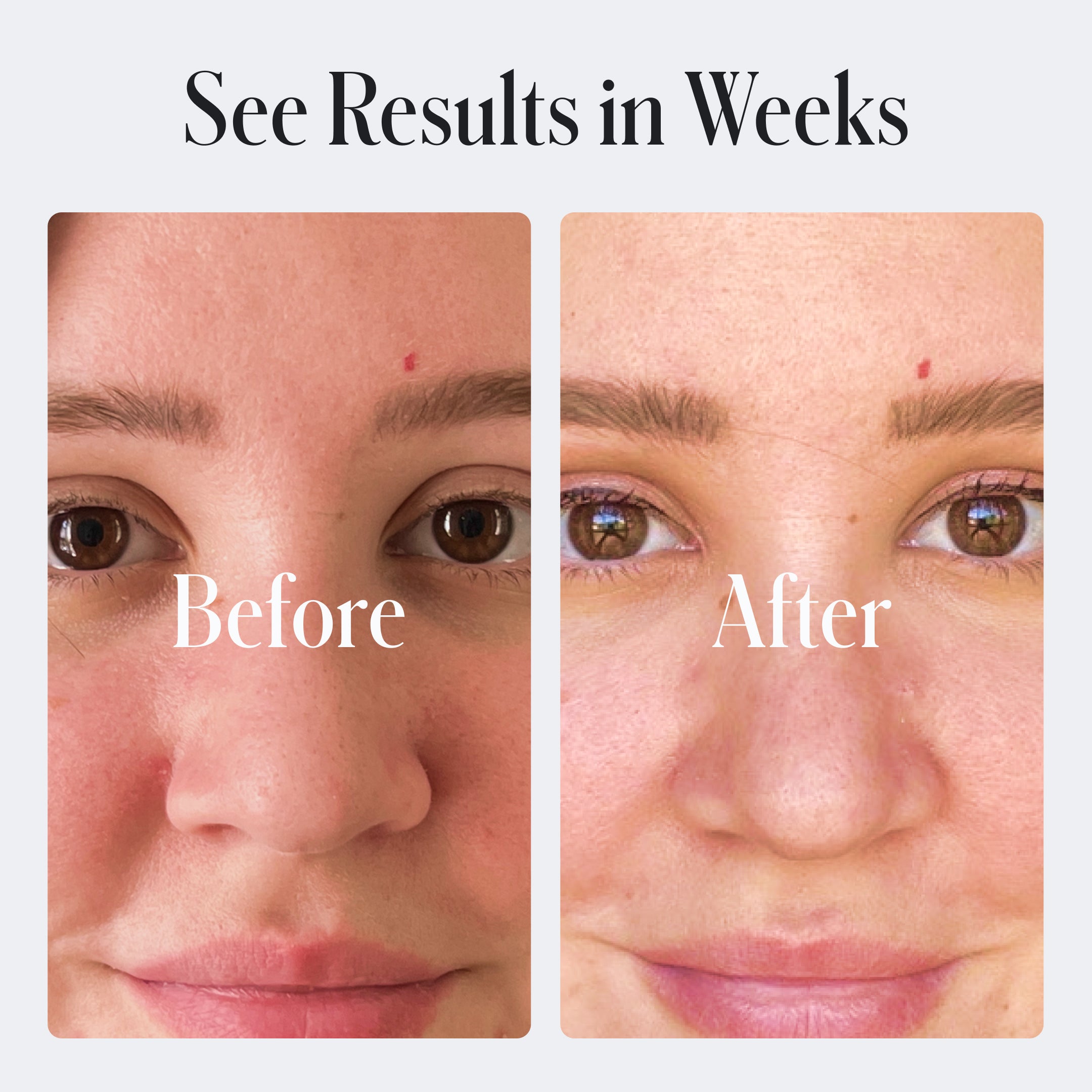 Geologie Acne Control Face Wash