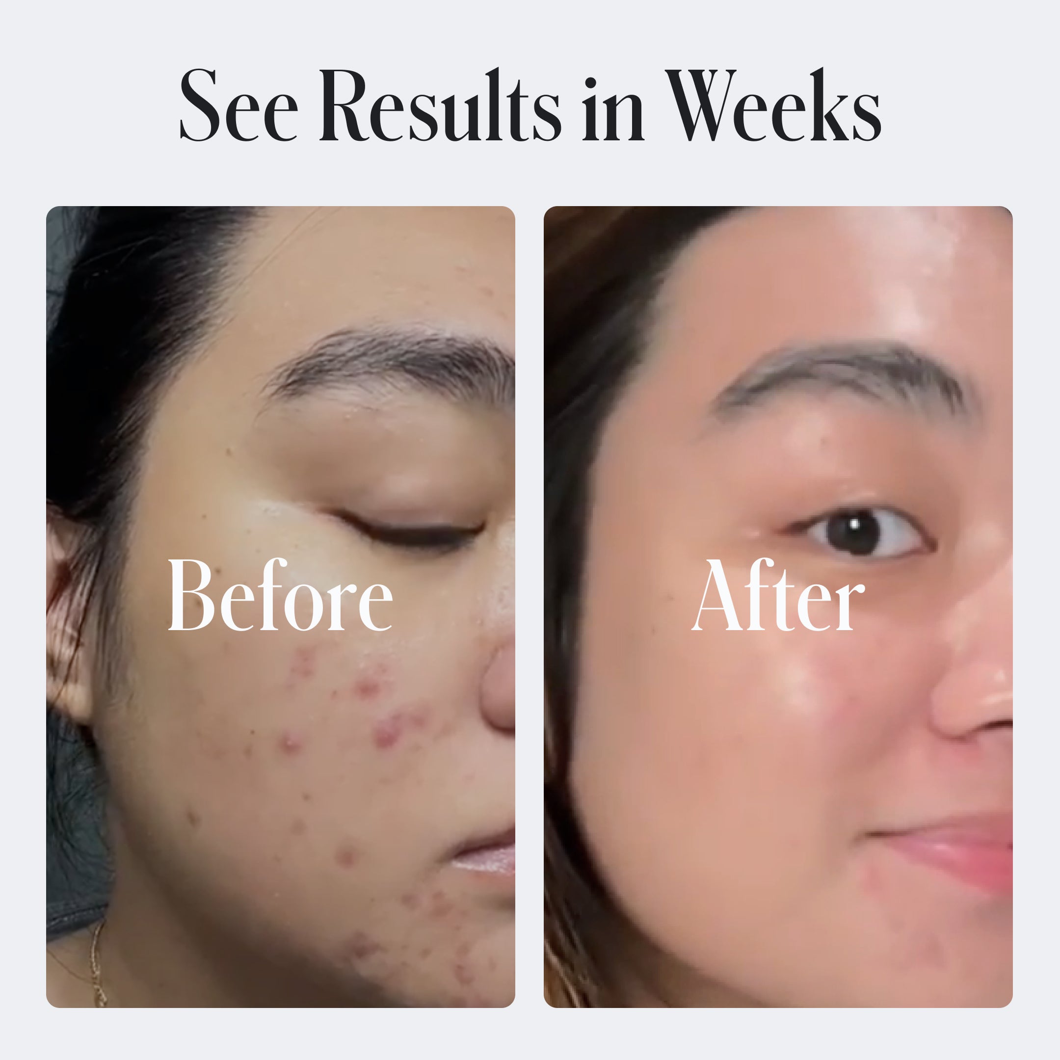 Geologie Clear Skin Face Cream