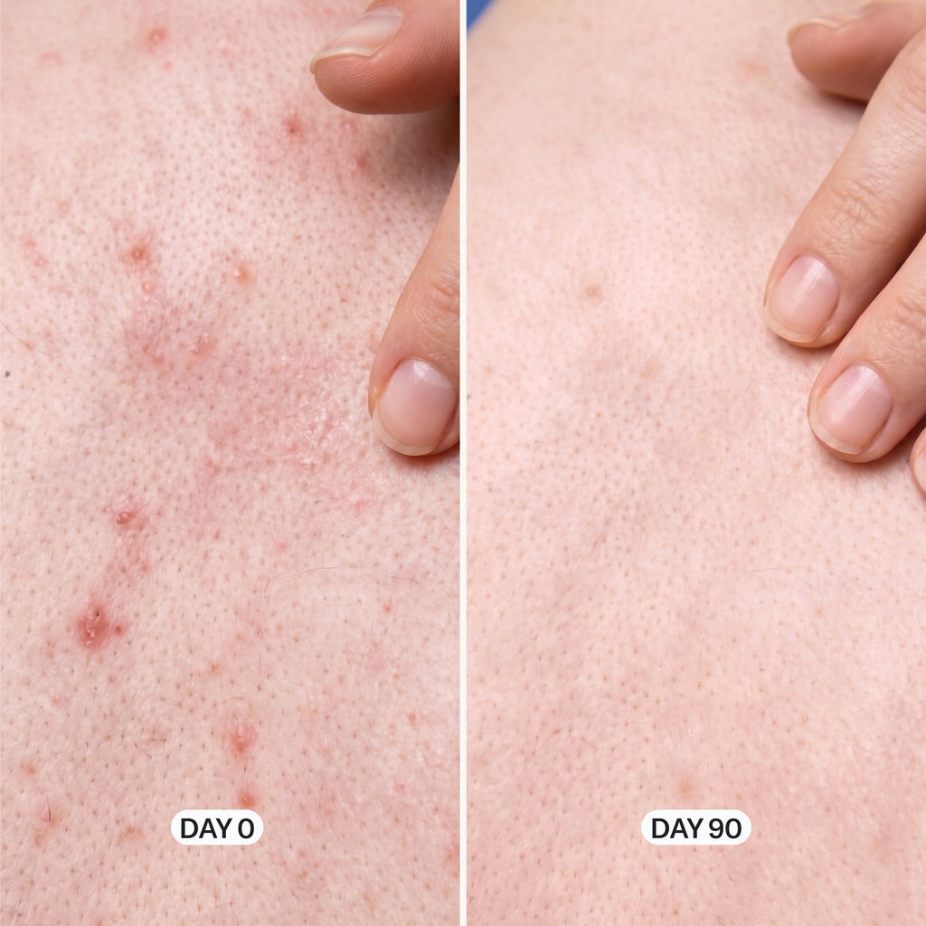 Geologie Acne Control Body Wash