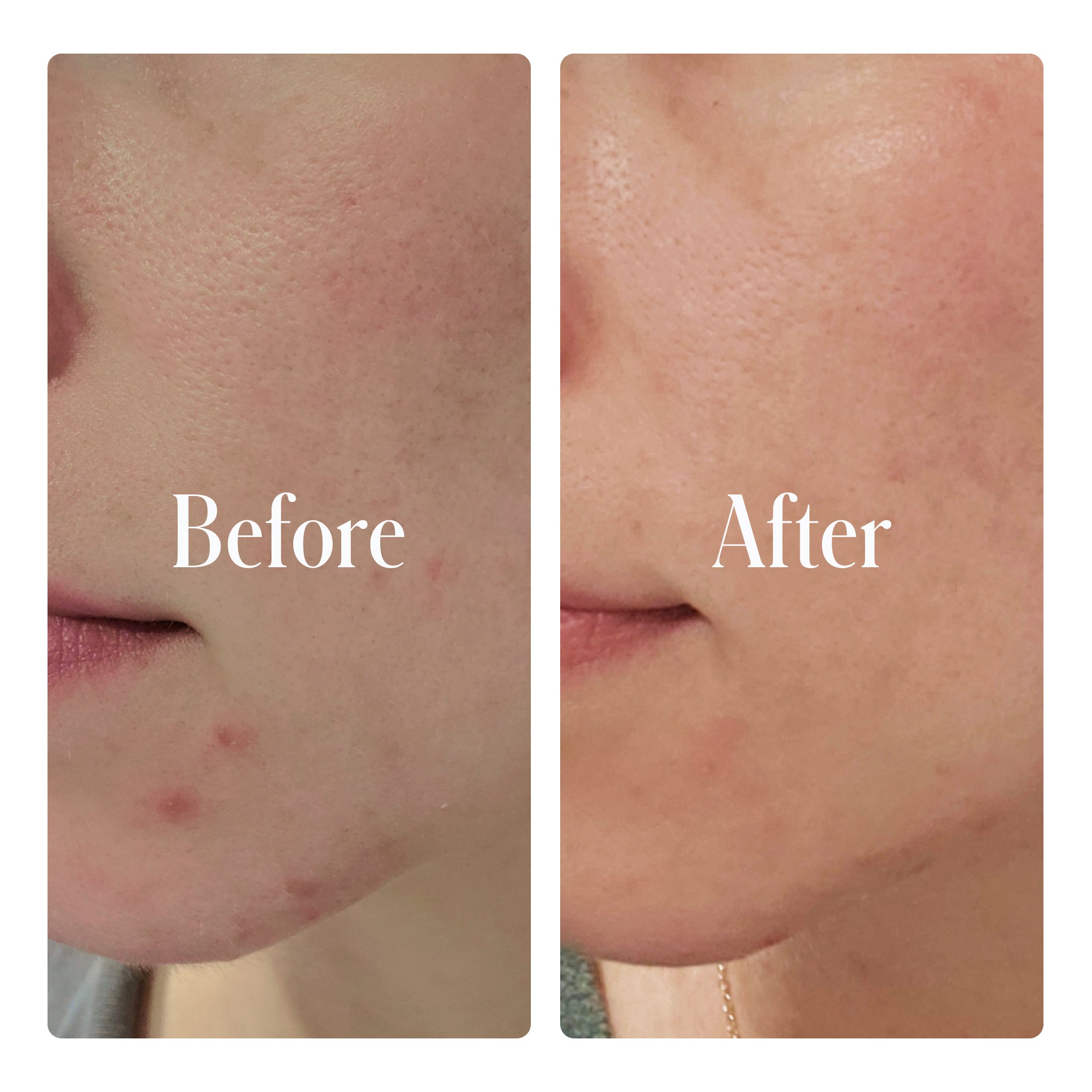 Geologie Clear System Face Routine