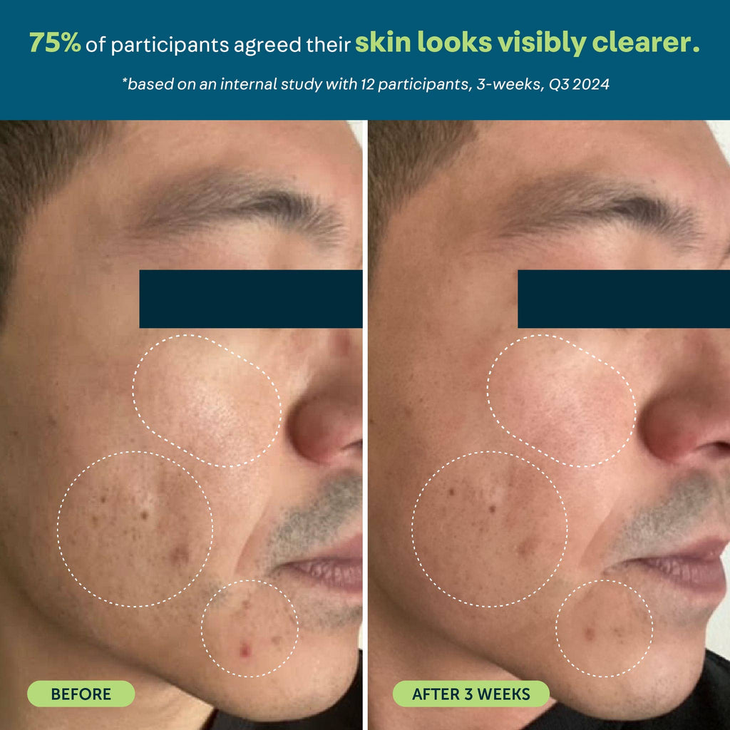 Oars + Alps Anti-Everything Men's Face Serum Acne Fighting