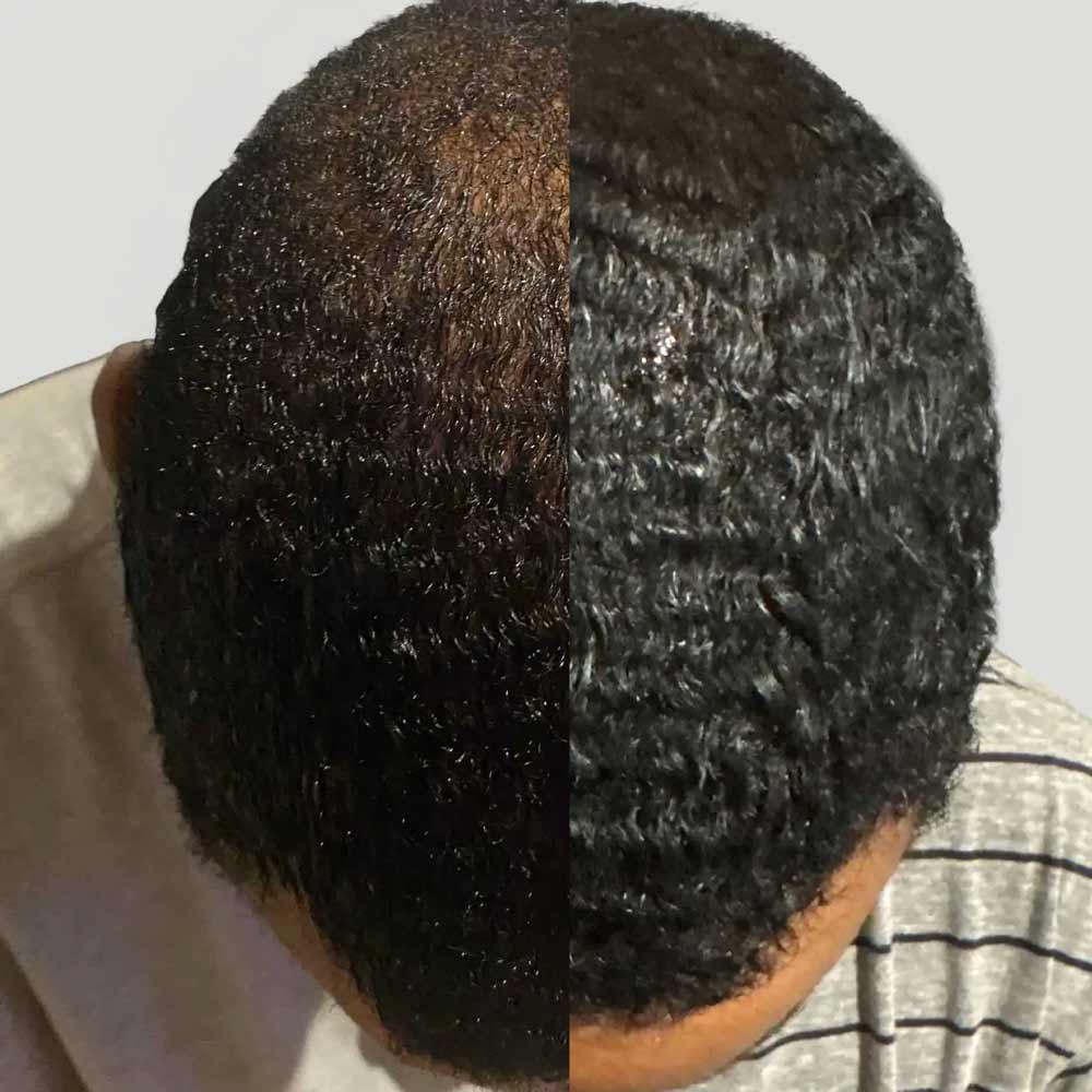 MARO17 Fuller Hair Collagen Scalp Shot